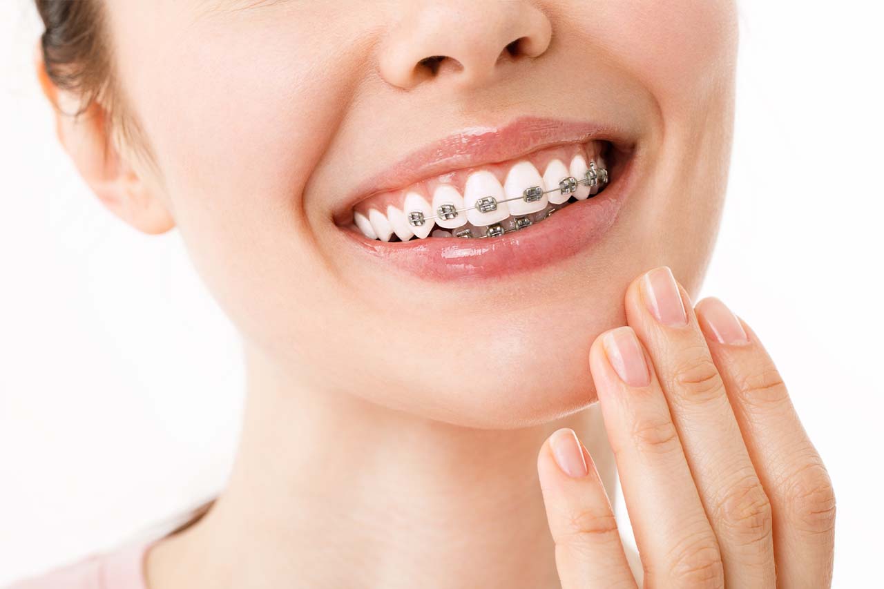 Clear Aligners or Braces: Which Is Right for You? - Orthodontist